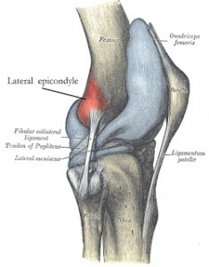 Lateral epicondyle; where IT Band pain is typically felt